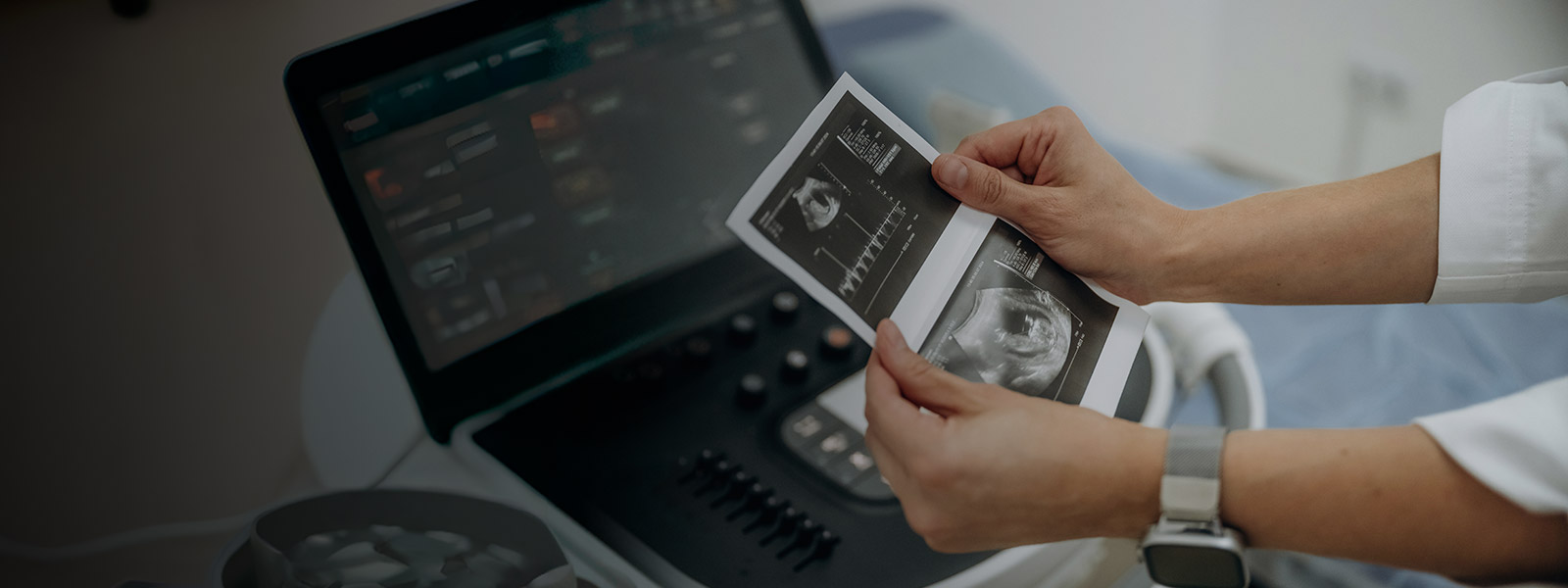 Ultrasound Thermal Paper