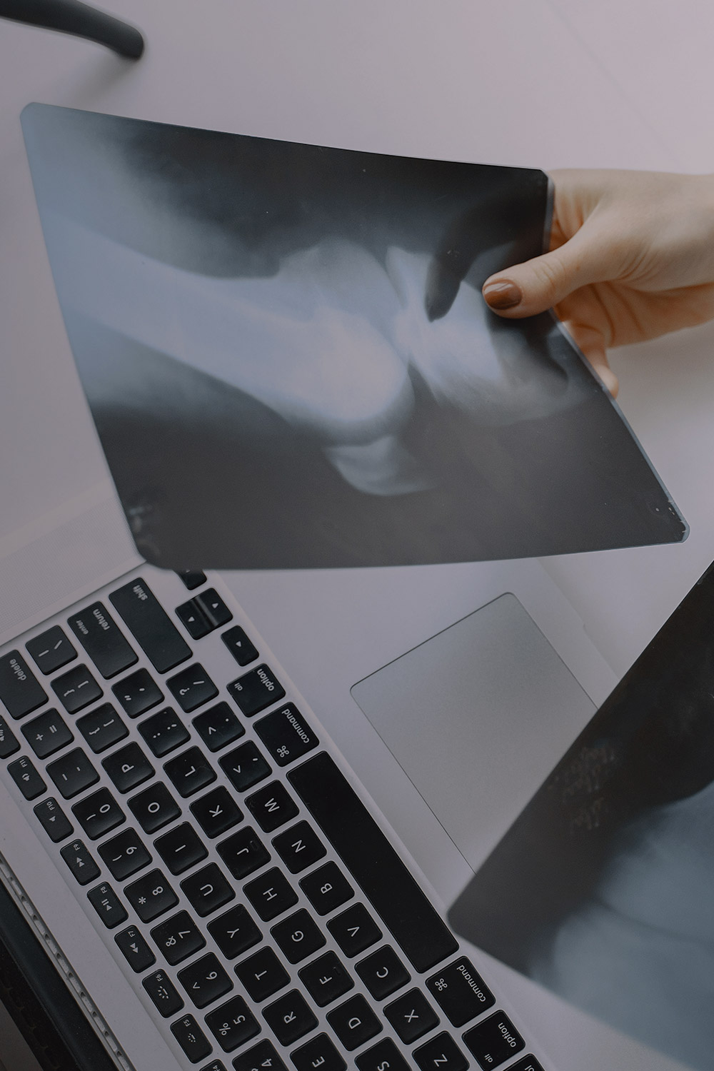 X Ray Films