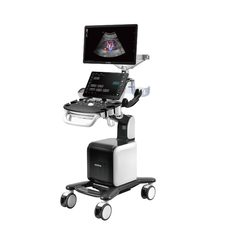 Color Doppler | Consona N8 | Mindray