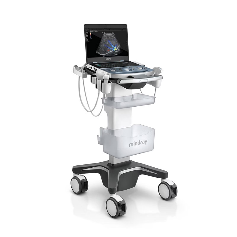 Color Doppler | MX7 | Mindray