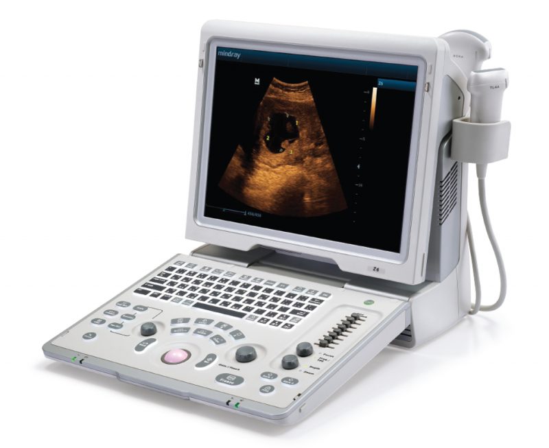 Portable Color Doppler | Z6 |Mindray