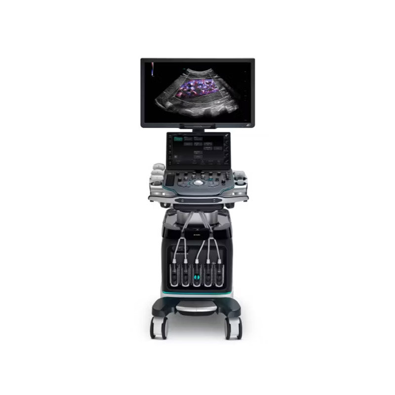 Color Doppler | Resona A20 | Mindray