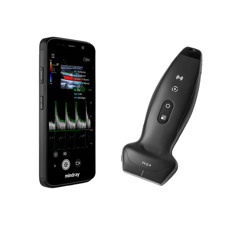 TE Air Wireless Handheld Ultrasound | Mindray