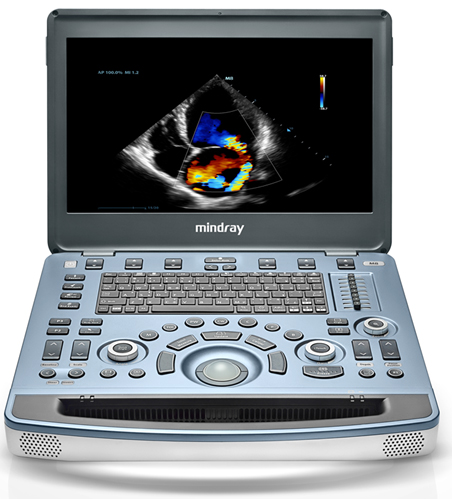 mindray-M8-ultrasound